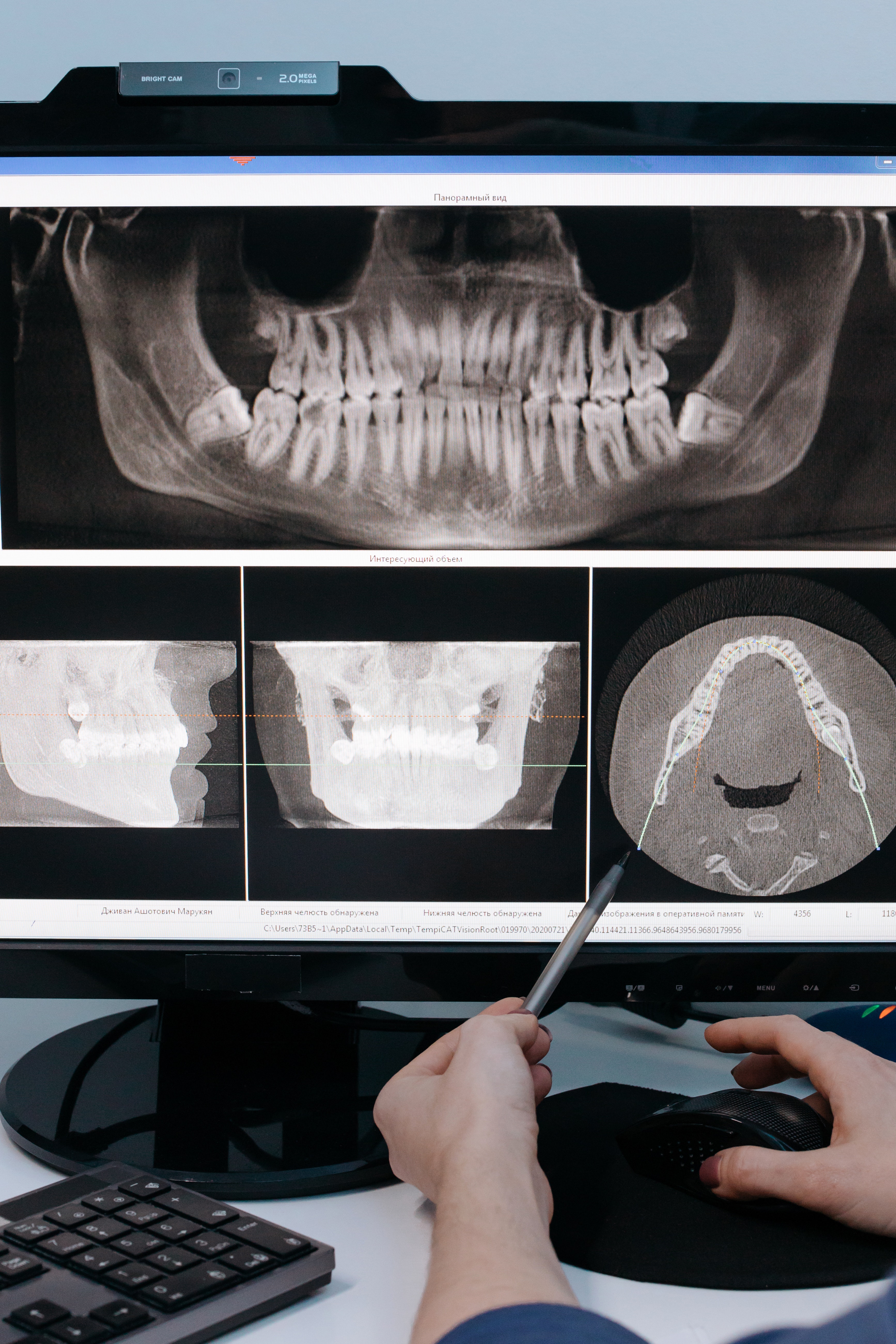 Zubné implantáty U.S. Center